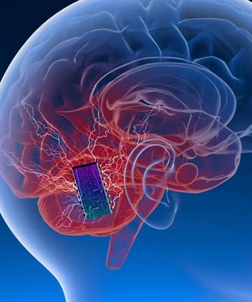 Interfaces Cerebro-Computadora (BCI).